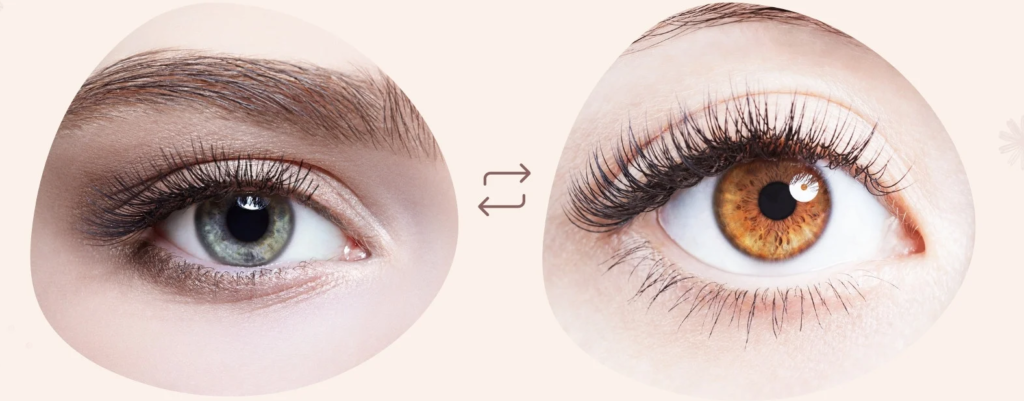 dark circles removal best cream